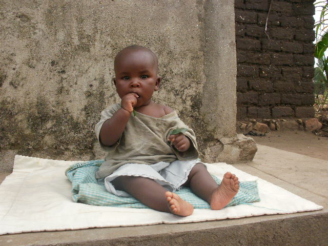 Un enfant victime de malnutrition au Burundi